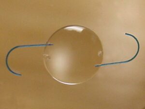 Example of an Intraocular lens insert