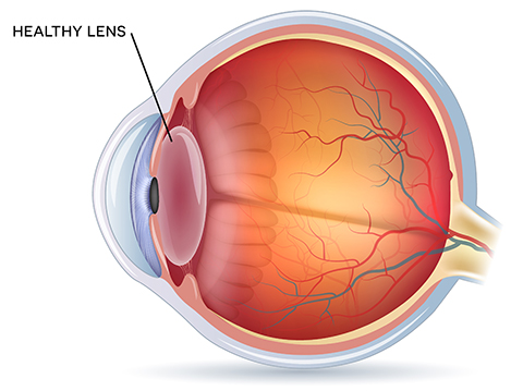 Healthy Lens diagram