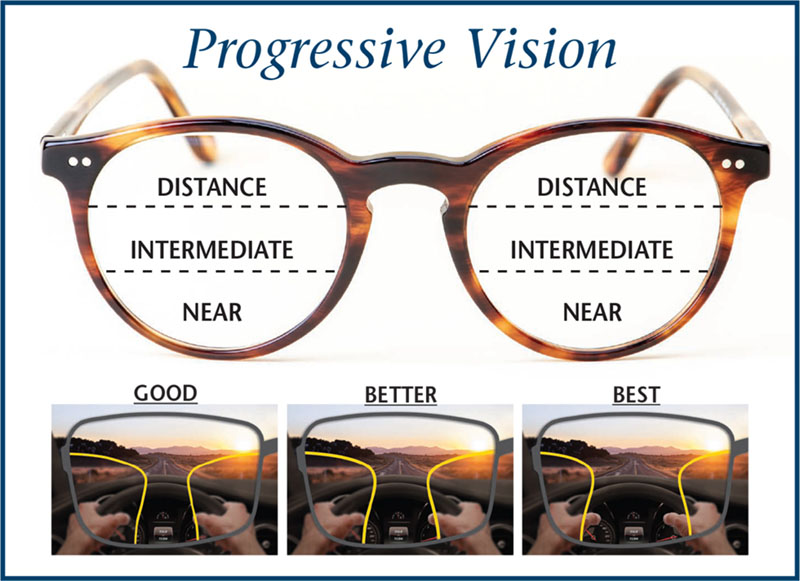 Progressive Vision